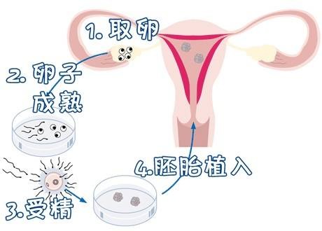 关于素竹生殖